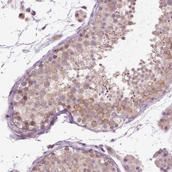 XK X-linked Kx blood group Antibody, Novus Biologicals:Antibodies:Primary